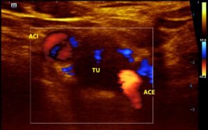 Fellowship em Doppler Vascular - Fluxo Cursos e Treinamentos